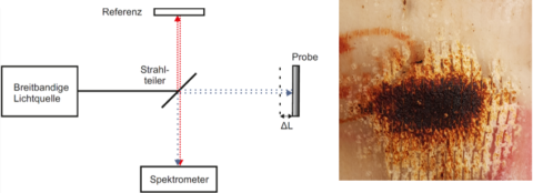 Zum Artikel "FP: Optische Abstandsmessung zur Charakterisierung von Verbrennungen"