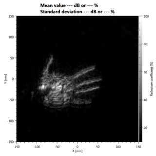 Zum Artikel "MA:  Radarbildgebung zur Abbildung der menschlichen Hand mit Compressed Sensing"
